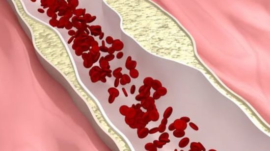 How to Lower Cholesterol? - Simple Ways