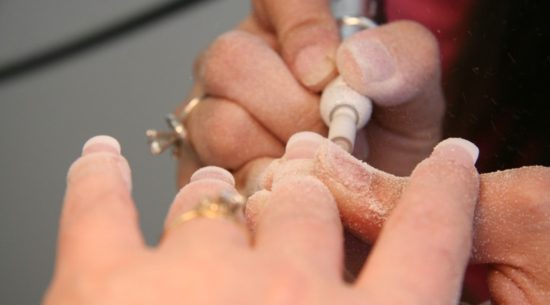 Professional Removal Options and Their Benefits